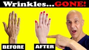 Wrinkled, Dry Hands? This Fix Makes Them Look Younger!